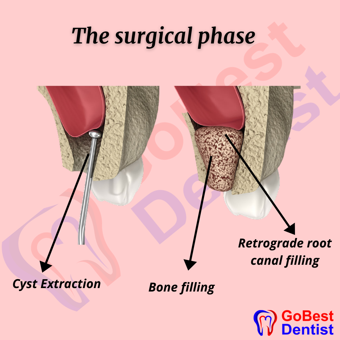 Oral-and-Maxillofacial-surgery