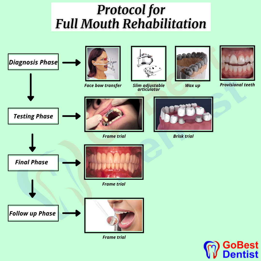 Full mouth rehabilitation surgery